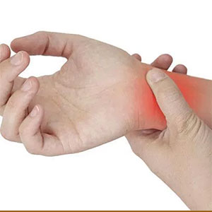 Carpal Tunnel Syndrome